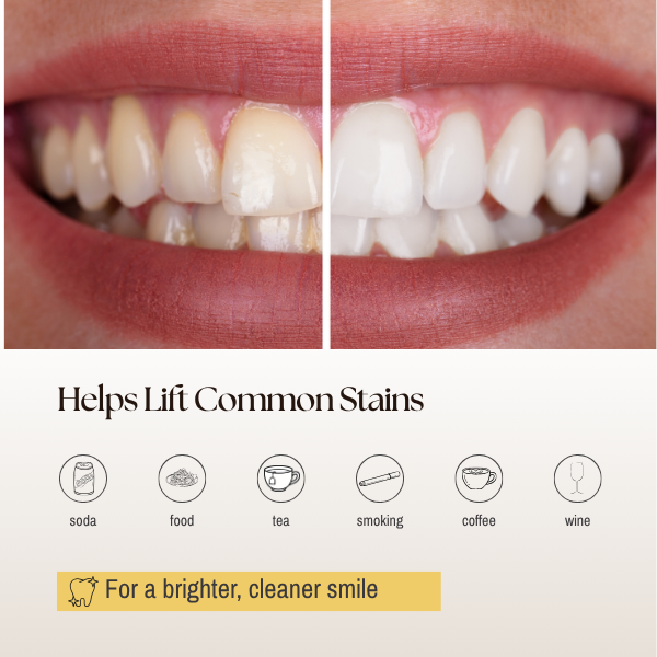 At-Home Teeth Whitening System