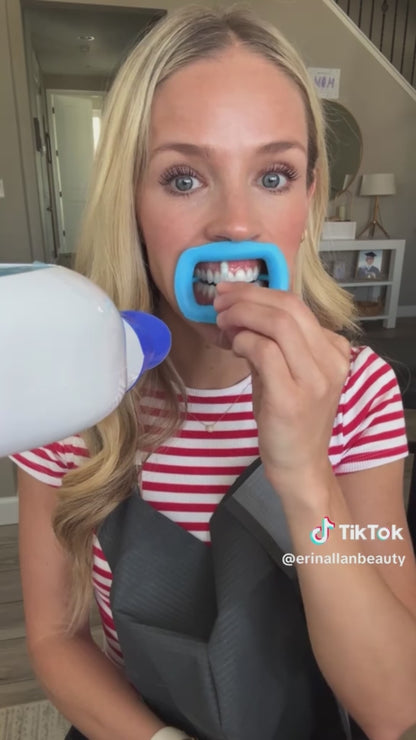 At-Home Teeth Whitening System
